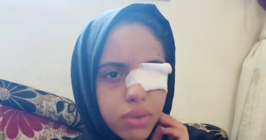 تفاصيل إصابة طفلة بطلق خرطوش أثناء حنة عروسة بالشرقية.. صور