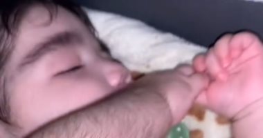 حالة نادرة لرضيع أمريكى يغطي الشعر جسمه بسبب عقار طبى .. فيديو وصور