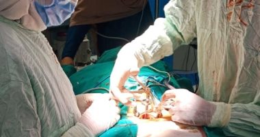 فى اليوم العالمى للقلب.. نجاح جراحة معقدة لإزالة ورم بالقلب بالإسماعيلية 