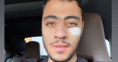أكرم توفيق يكشف عن صورة جديدة تظهر إصابة وجهه خلال معسكر المنتخب
