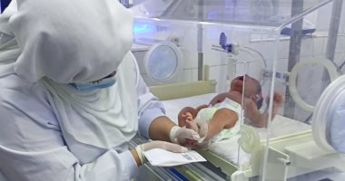 فحص 1391 طفلا بمبادرة الكشف المبكر عن الأمراض الوراثية للأطفال المبتسرين بالشرقية