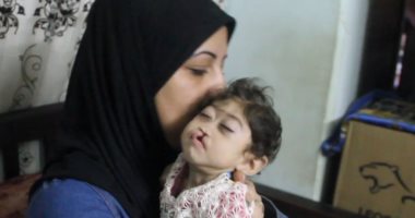 الطفلة مودة ولدت مصابة بضمور فى المخ وثقب بالقلب.. وأسرتها تناشد لعلاجها