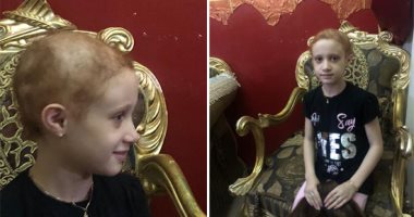 مأساة طفلة تعانى من مرض نادر يصيب 1 فى المليون.. رودينا تعانى من تساقط شعرها.. الأم: ابنتى شعرها يسقط وعمرها 9 أشهر والأطباء فشلوا فى تشخيص حالتها.. وتؤكد: ألبسها باروكة خارج البيت حتى لا تتعرض للتنمر