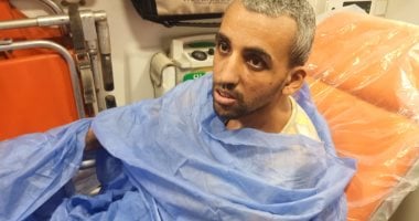 بث مباشر.. مستشفى بنى سويف يستقبل الشاب عمرو صاحب اعوجاج العظام