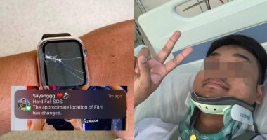 اتصلت بالطوارئ تلقائيا.. ساعة ذكية تنقذ حياة شاب بعد تعرضه لحادث.. صور