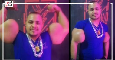 أغرب دراع فى مصر.. حجمه أكبر من لاعبى كمال الأجسام وخطر أى حد يقلده