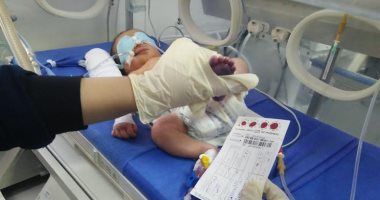انطلاق مبادرة الكشف المبكر عن الأمراض الوراثية للأطفال حديثى الولادة بالغربية
