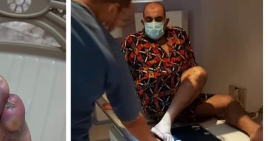 محسن منصور بعد سقوط قطعة ديكور على قدمه: العين صابتنى وربنا نجانى