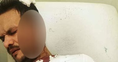 شقيقان يعتديان على شاب بالساطور فى أبو صوير بالإسماعيلية.. صور
