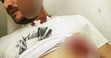 ضبط مرتكبى واقعة الاعتداء على شاب بالساطور فى أبو صوير بالإسماعيلية.. صور