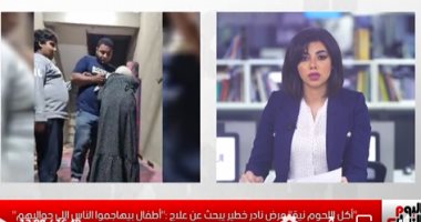 "أكل اللحوم نية" مرض نادر خطير يصيب طفلين والأسرة تبحث عن علاج 