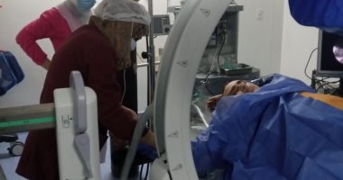 استخراج حصوة مرتجعة بحوض الكلى اليسرى بمنظار الكلى بمستشفى السنبلاوين لأول مرة