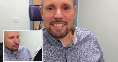 بريطانى يحصل على أول عين صناعية باستخدام طابعة ثلاثية الأبعاد.. صور