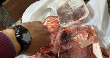 ضبط لحوم ودواجن غير صالحة للاستهلاك الآدمى خلال حملة بالغربية.. صور