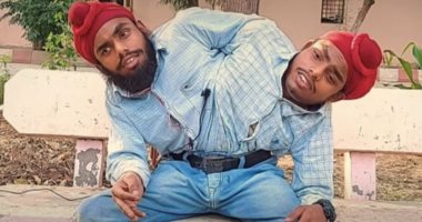 توأم هندى ملتصق يحصلان على أول وظيفة لهما بعد19عامًا من تخلى والديهما عنهما
