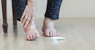 من هم الأشخاص الأكثر عرضة للإصابة بالغرغرينا وما أعراضها؟