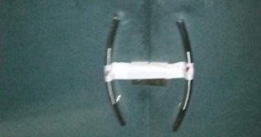 التحقيقات: واقعة التعدي على عامل في مركز طبي بالطالبية حدثت منذ عام