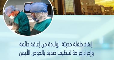 إنقاذ طفلة حديثة الولادة من إعاقة دائمة بمستشفى حورس بالأقصر