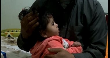 يا وجع القلب.. آلاء 3 سنوات وعايشة بنصف جمجمة وتحلم بإجراء عملية "فيديو"