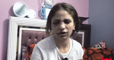 110 غرز بوجه سيدة على يد زوجها بسبب خلافات أسرية بالجيزة فى "ساعة شيطان"