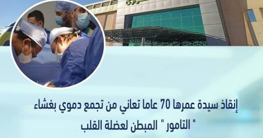 أطباء مستشفى طيبة بإسنا ينقذون سيدة تعانى من تجمع دموى بغشاء التامور بالقلب