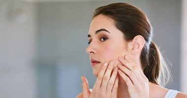 وصفات طبيعية لعلاج حب الشباب في المنزل .. لو عندك مناسبة مهمة قريب