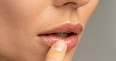 وصفات طبيعية لعلاج تشقق الشفاه.. ودعى الإحراج والألم