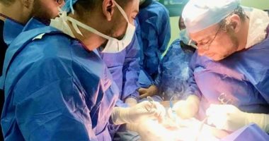 نجاح جراحة استخراج هاتف محمول ولفافة من معدة مريض بمستشفى كفر الزيات