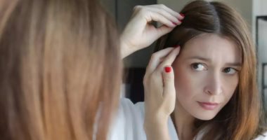 وصفات طبيعية للتخلص من الشعر الأبيض .. مش هتحتاجى لصبغة أو حنة
