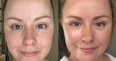شركة مستحضرات تجميل تحقق 30 ألف دولار أرباحًا يومية بسبب مصل "معجزة" للبشرة