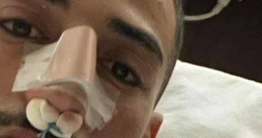 محمد عبد المنعم يجرى جراحة كسر الأنف بعد إصابته أمام السنغال