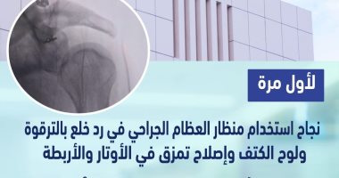 جراحة ناجحة لرد خلع في الترقوة ولوح الكتف باستخدام منظار العظام الجراحي بالأقصر