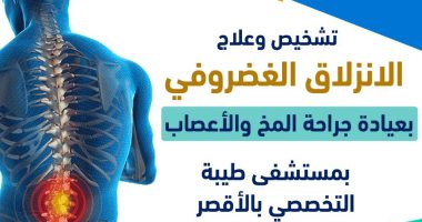 تعرف على تفاصيل عمل عيادة جراحة المخ والأعصاب بمستشفى طيبة بإسنا