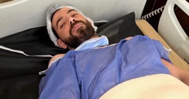 حليمو "سموحة" يجرى جراحة الرباط الصليبى بنجاح