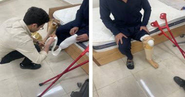 وزارة الداخلية توفر أطرافا صناعية لنزلاء بمنطقة مراكز إصلاح وتأهيل بدر