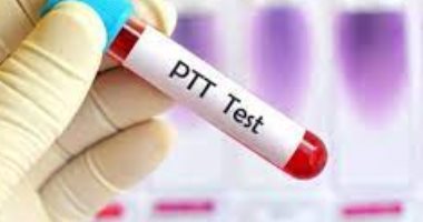 ما دور تحليل "PTT" في الكشف عن الإصابة بالجلطات؟