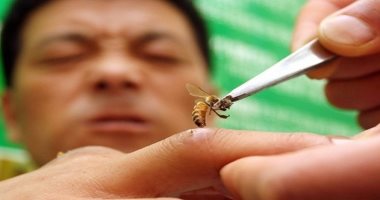 ما تتعالجش بيه.. لسعة النحل قد تسبب الحساسية الشديدة وتؤدى إلى الوفاة  