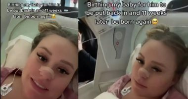 الطب بيعمل المعجزات.. سيدة تلد طفلها مرتين بفارق 11 أسبوعا