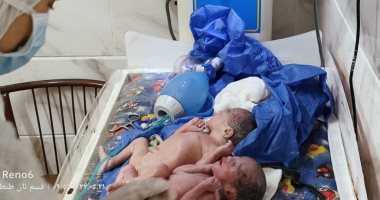 والد التوائم الـ5 بالغربية: زوجتى تعانى من ورم بالثدى والطبيب نصحها بالحمل للتعافى