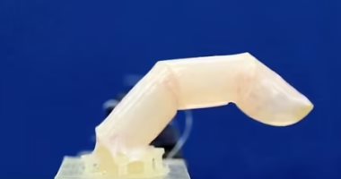 اليابان تطور روبوتا بـ"جلد" حى تلتئم جروحه.. اعرف التفاصيل