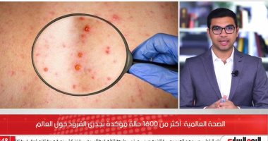 انتشار غير متوقع لفيروس جدري القرود.. 1500 إصابة مؤكدة حول العالم حتى الآن