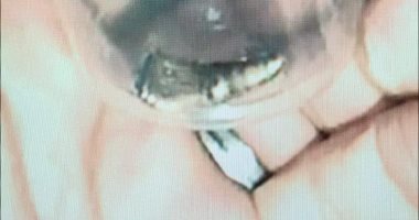 رصاصة خارقة للدروع أودت بحياة الصحفية شيرين أبو عاقلة (صورة)