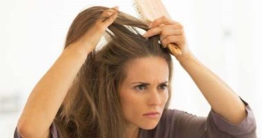 وصفات طبيعية لعلاج قشرة الرأس في المنزل.. من خل التفاح لقشر البرتقال