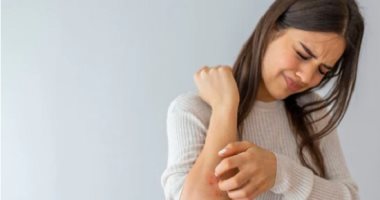 لماذا يلدغ الناموس شخصا ويترك آخر؟.. 7 أشياء تجذب البعوض لجسم الإنسان