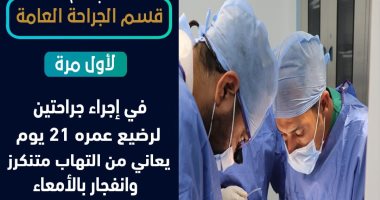 جراحتان ناجحتان لطفل "21 يوما" كان يعانى من التهاب وانفجار بالأمعاء فى الأقصر