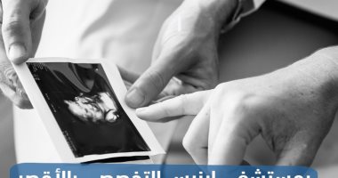 تعرف على جدول مواعيد العيادات الخارجية فى مستشفى إيزيس بالأقصر.. انفوجراف