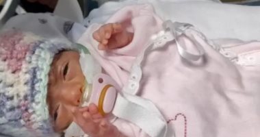 83 يوما في العناية المركزة.. رضيعة تنجو من الموت بعد ولادتها بوزن 330 جرام.. صور
