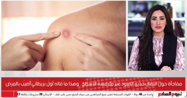 مفاجأة حول انتقال جدرى القرود.. وهذا ما قاله أول بريطانى أصيب بالمرض.. فيديو