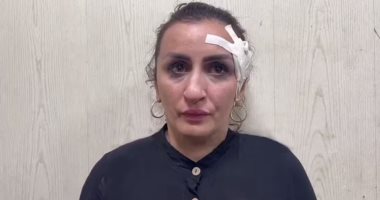 ما عندهاش رحمة.. أم روسية تبيع طفلها لدفع ثمن عملية تجميل بالأنف "صور"