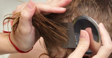 اعرفى إزاى ممكن تتخلصى من حشرات الشعر بزيت الزيتون